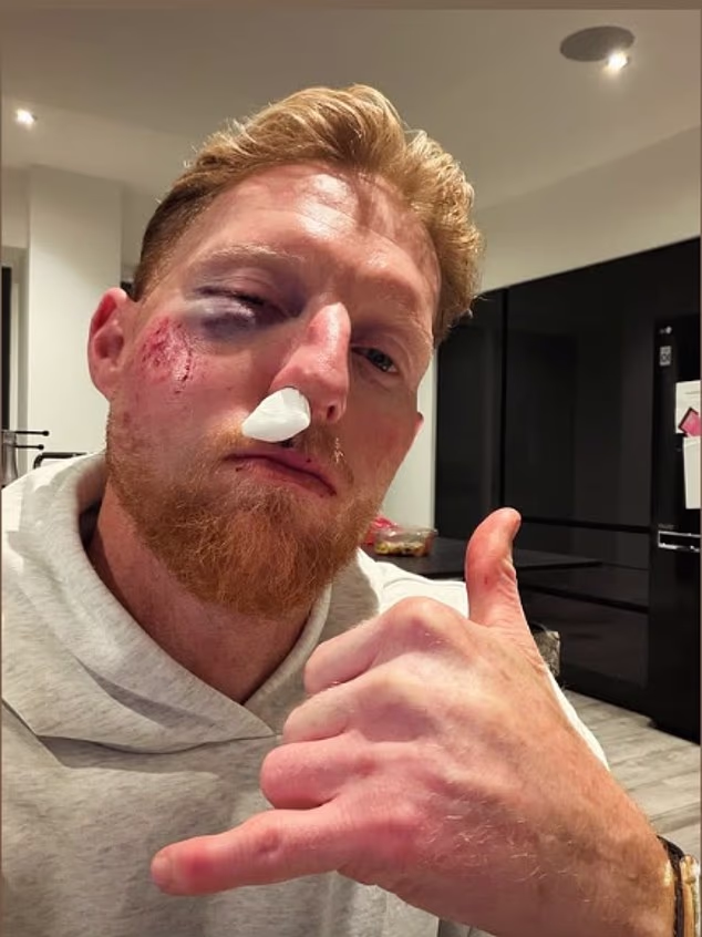 Ben Stokes rivela di essere “fortunato” ad essere vivo dopo che un infortunio da cricket ha lasciato il volto del capitano inglese in un “pasticcio” e ha richiesto un intervento chirurgico importante: “Fortunatamente sono ancora qui”